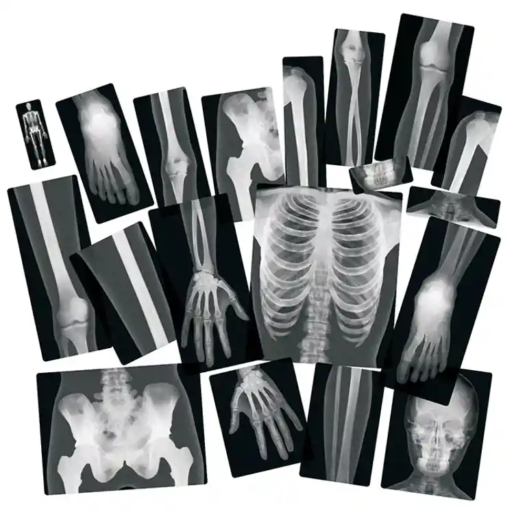 True to Life Human X-Rays