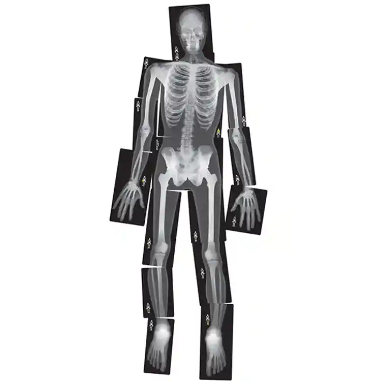 True to Life Human X-Rays